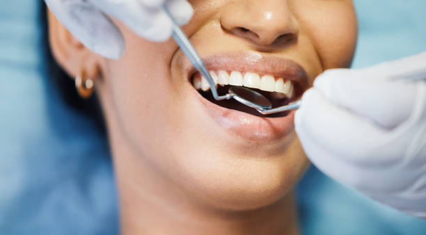 Best Emergency Treatment for Oral Infections in Britt, IA