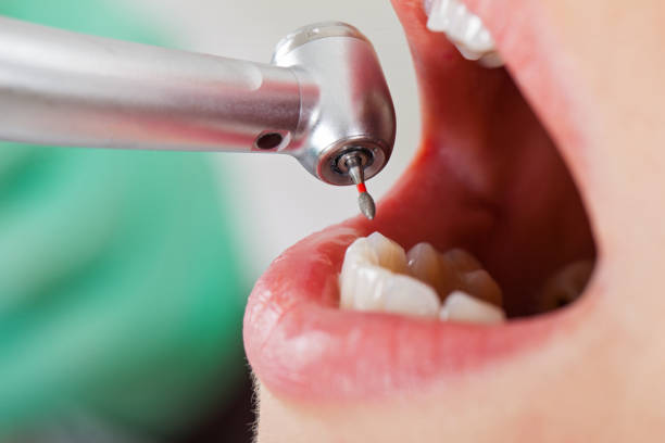 Best Emergency Dental Care for Sports Injuries in Britt, IA
